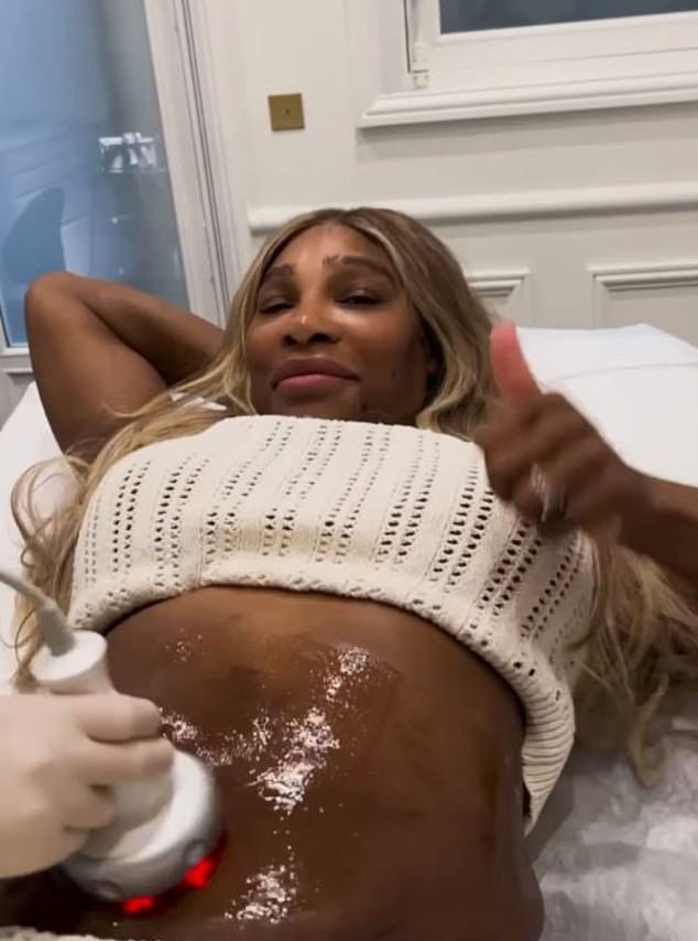 Серена Уильямс выложила в социальной сети видео, в котором она восстанавливает фигуру при помощи спа-процедуры, которая помогает избавиться от рубцов на животе